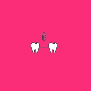 Установка импланта DENTIUM