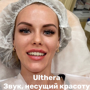 Альтера/ULTHERA