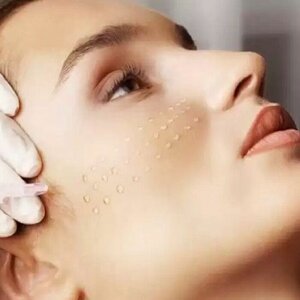 Биоревитализация Skinopro Active (1 мл.)