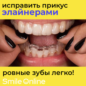 Элайнеры