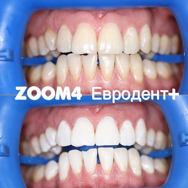Prices at Dental Zar in - Yandex Maps