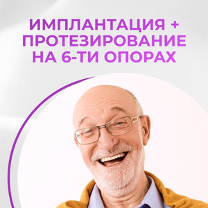 Зубы за день All-on-6