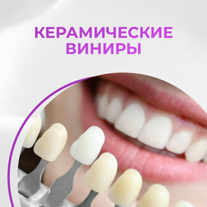 Установка керамических виниров (E-max) всё включено