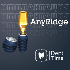 Южно-Корейский имплантат AnyRidge