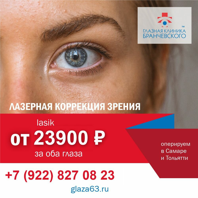 Бранчевского самара 6 просека - найдено 61 картинок