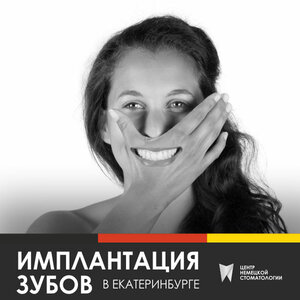 Имплантация зубов