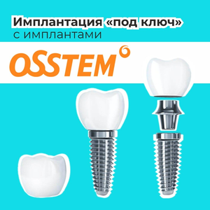 Имплантация под ключ с имплантами Osstem
