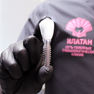 Имплантация Neodent (Неодент) и циркониевая коронка