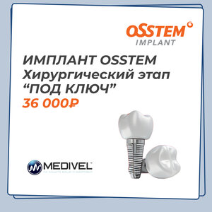 Имплантация "Подключ" хирургический этап Osstem