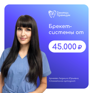 Брекеты от