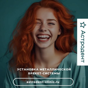 Брекеты металлические 