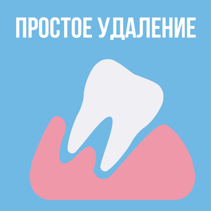 Простое удаление зуба