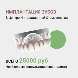 Установка имплантата Riellen's