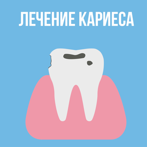 Лечение кариеса 