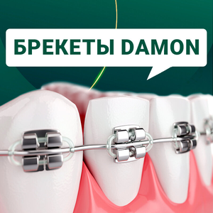Брекеты Damon