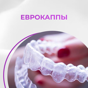 Еврокаппы – выравнивания зубов и коррекции прикуса