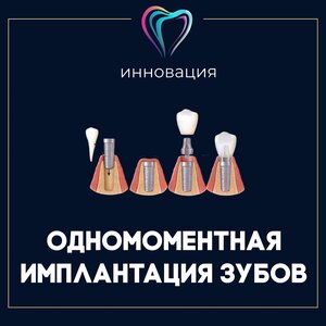 Имплантация зубов от