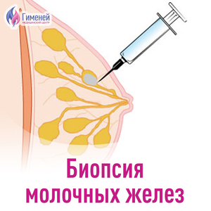 Трепан биопсии молочной железы