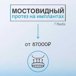 Мостовидный протез на имплантах от 87000
