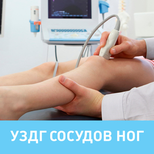 УЗДГ сосудов ног