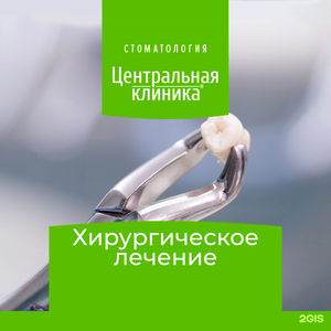 Удаление зуба простое