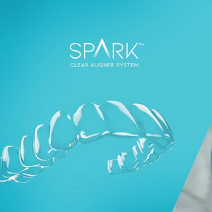Элайнеры (каппы) Spark для выравнивания зубов