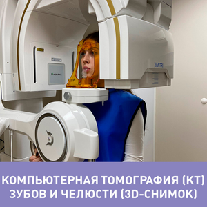 Компьютерная томография зубочелюстной системы