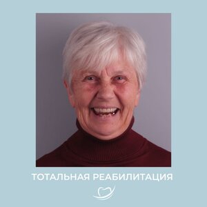 Все виды протезирования зубов