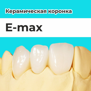 Керамическая коронка E max