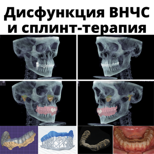 Лечение и диагностика ВНЧС