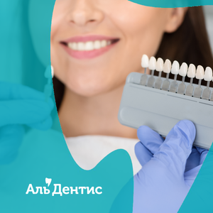Отбеливание зубов стоматология Альдентис в Тюмени