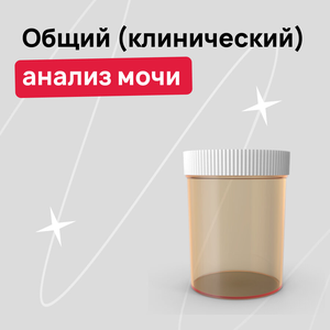 Общий анализ мочи