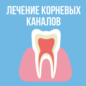 Лечение корневых каналов