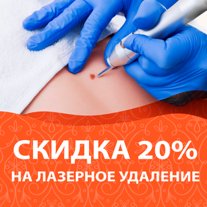-20% на лазерное удаление новообразований