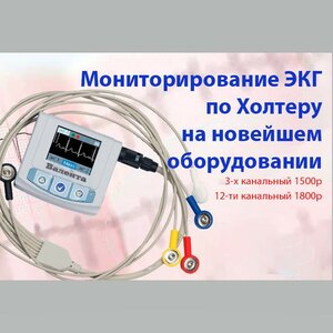 Суточное мониторирование ЭКГ по Холтеру