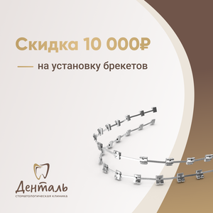 Скидка на брекеты
