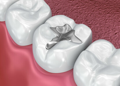 Лечение зубов в Atlantis Dental