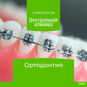 Постановка брекет-системы на один зубной ряд 