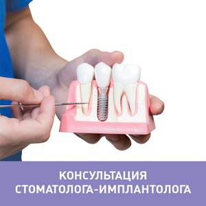 Консультация врача-имплантолога