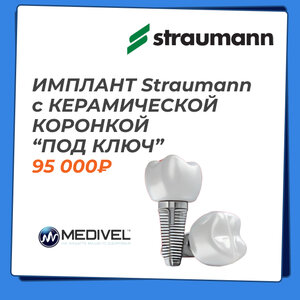 Имплант Straumann с керамической коронкой “ПОД КЛЮЧ” 