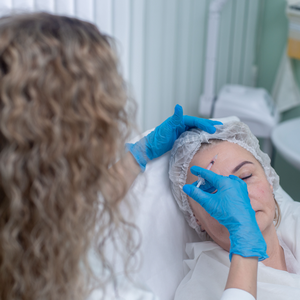 Мезотерапия кожи головы Dermaheal