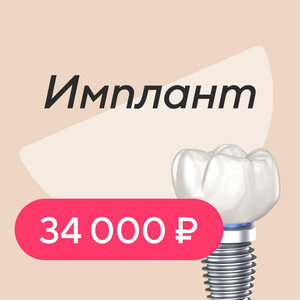 Имплант с установкой
