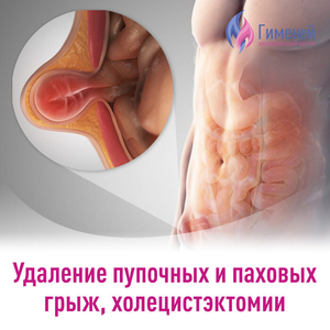 Грыжесечение. Холецистэктомии