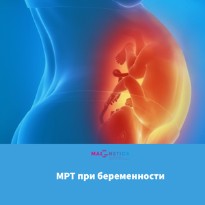 МРТ при беременности