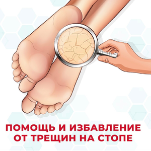 Трещины и сухость стопы