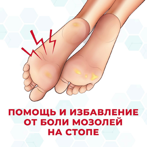Мозоли и натоптыши на стопе.Обработка ороговений
