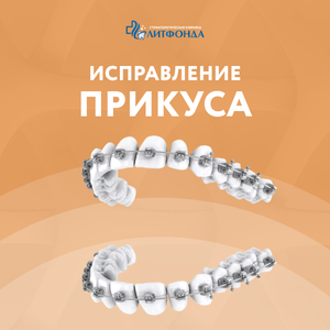  Исправление прикуса