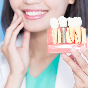 Импланты Dentium