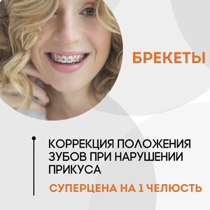 Брекеты 
