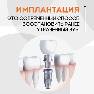 Имплантация